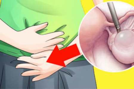 ألام الدورية الشهرية